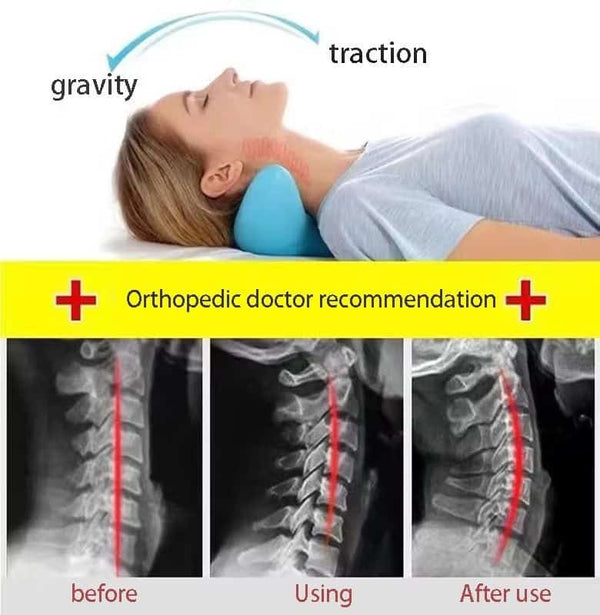 Neck Hump Corrector Neck Massage Pillow Correction Artifact Sleeping Special Neck Relaxer Support Traction
