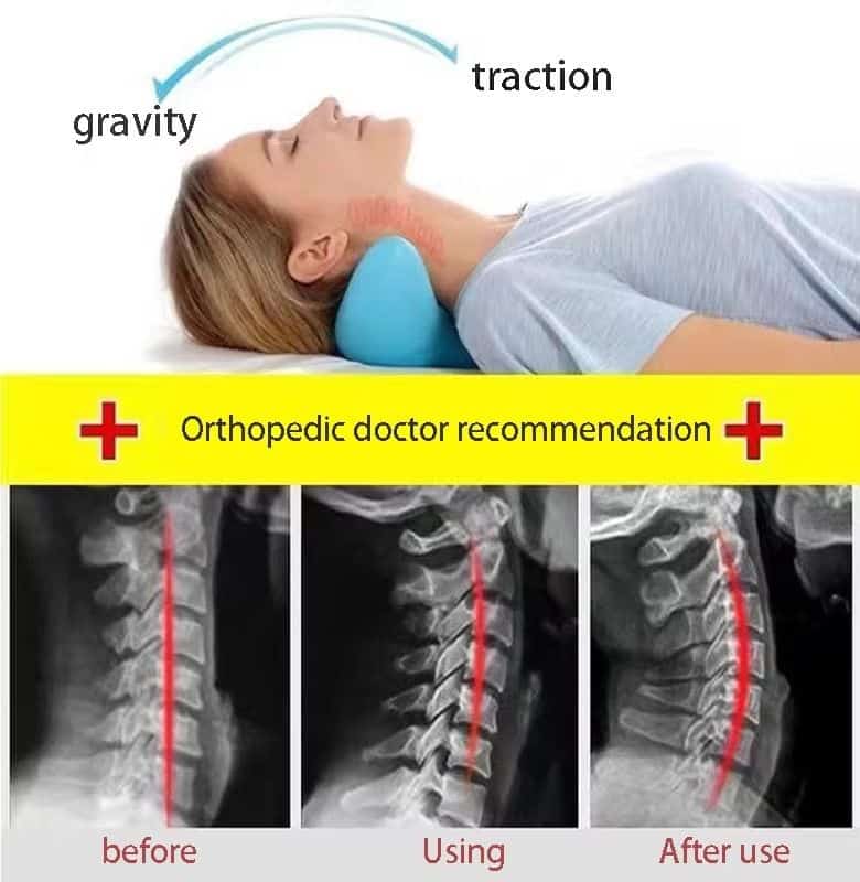 Neck Hump Corrector Neck Massage Pillow Correction Artifact Sleeping Special Neck Relaxer Support Traction